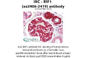 Image no. 1 for anti-RAP1 Interacting Factor Homolog (RIF1) (AA 2406-2419) antibody (ABIN1738875)