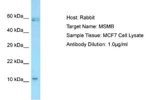 Host: RabbitTarget Name: MSMBAntibody Dilution: 1. (MSMB Antikörper  (C-Term))
