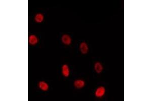 ABIN6275723 staining HepG2 by IF/ICC. (ZNF691 Antikörper  (Internal Region))