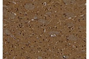 ABIN6277588 at 1/100 staining Rat brain tissue by IHC-P. (BCL11A Antikörper  (Internal Region))
