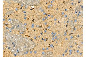 ABIN6259884 and ABIN6266962 at 1/100 staining Rat brain tissue by IHC-P. (ALDOC Antikörper  (C-Term))