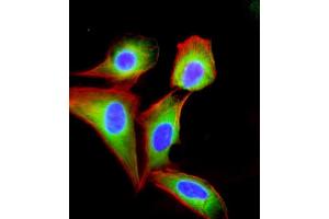 Immunofluorescence (IF) image for anti-Eukaryotic Translation Initiation Factor 2B, Subunit 3 Gamma, 58kDa (EIF2B3) (AA 110-452) antibody (ABIN6243199)