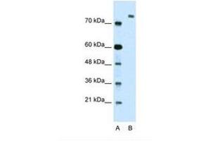 Image no. 1 for anti-Zinc Finger Protein 261 (ZMYM3) (AA 51-100) antibody (ABIN324361)