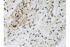 Immunohistochemistry (Paraffin-embedded Sections) (IHC (p)) image for anti-serine/threonine Kinase 11 (STK11) (AA 134-433) antibody (ABIN3022973)