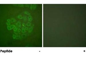 Immunofluorescence analysis of A-549 cells, using NR3C1 polyclonal antibody . (Glucocorticoid Receptor Antikörper)