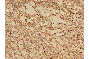 Immunohistochemistry (IHC) image for anti-NADH Dehydrogenase (Ubiquinone) 1 alpha Subcomplex, 5, 13kDa (NDUFA5) (AA 38-114) antibody (ABIN7160905)