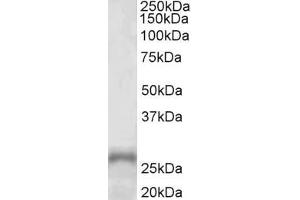 ABIN5539795 (1µg/ml) staining of Human Adrenal Gland lysate (35µg protein in RIPA buffer). (PHOX2A Antikörper  (AA 165-179))