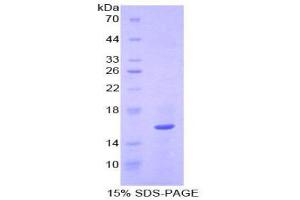 SDS-PAGE (SDS) image for Quiescin Q6 Sulfhydryl Oxidase 1 (QSOX1) (AA 394-519) protein (His tag) (ABIN1879423)