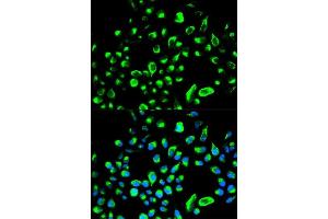 Immunofluorescence analysis of HeLa cells using YWHAQ antibody. (14-3-3 theta Antikörper  (AA 1-245))