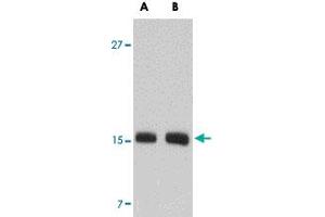 Western blot analysis of SKA2 in NIH/3T3 cell lysate with SKA2 polyclonal antibody  at (A) 0. (FAM33A Antikörper  (N-Term))