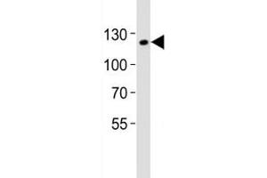 Western Blotting (WB) image for anti-Sirtuin 1 (SIRT1) (AA 566-601) antibody (ABIN3032583)