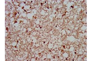 IHC image of ABIN7155794 diluted at 1:400 and staining in paraffin-embedded human brain tissue performed on a Leica BondTM system. (MKX Antikörper  (AA 157-305))