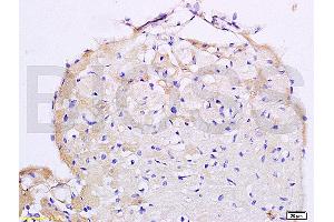 Angiotensin II Type 2 Receptor Antikörper