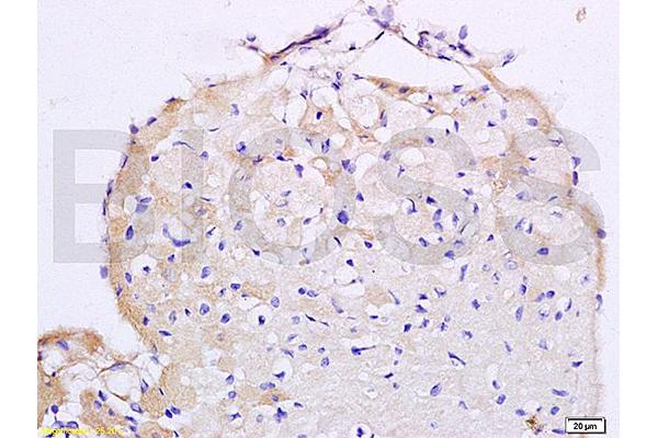 Angiotensin II Type 2 Receptor Antikörper