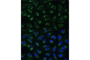 Immunofluorescence analysis of U-2 OS cells using ETFB Polyclonal Antibody (ABIN7266916) at dilution of 1:100 (40x lens).