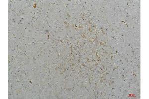 Immunohistochemistry (IHC) analysis of paraffin-embedded Mouse Brain Tissue using Cav2. (CACNA1B Antikörper)