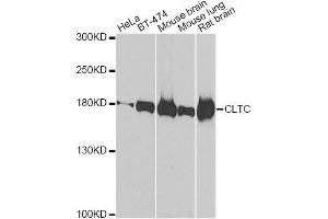 Western blot analysis of extracts of various cell lines, using CLTC antibody. (Clathrin Heavy Chain (CLTC) Antikörper)