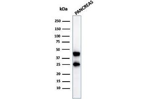 Western Blot Analysis of pancreatic tissue lysate using CPA1 Mouse Monoclonal Antibody (CPA1/2712). (CPA1 Antikörper)