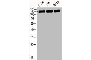 Western Blotting (WB) image for anti-Cadherin 1, Type 1, E-Cadherin (Epithelial) (CDH1) (N-Term) antibody (ABIN7188712)