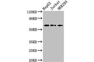 Western Blot Positive WB detected in: HepG2 whole cell lysate, Jurkat whole cell lysate, HEK293 whole cell lysate All lanes: CD96 antibody at 2. (CD96 Antikörper  (AA 306-395))