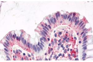 Anti-GPR15 antibody  ABIN1048731 IHC staining of human colon, surface epithelium. (GPR15 Antikörper  (Cytoplasmic Domain))