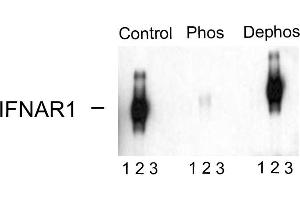 Western blots of immunoprecipitates from HEK 293 cells transfected with 1. (IFNAR1 Antikörper  (pSer535, pSer539))
