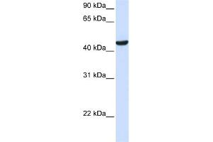 WB Suggested Anti-ZNF134 Antibody Titration: 0. (ZNF134 Antikörper  (Middle Region))