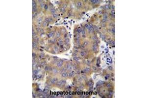 Immunohistochemistry (Paraffin-embedded Sections) (IHC (p)) image for anti-Eukaryotic Translation Initiation Factor 3 Subunit H (EIF3H) (AA 69-99), (N-Term) antibody (ABIN952050)