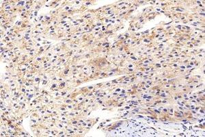 Immunohistochemistry (Paraffin-embedded Sections) (IHC (p)) image for anti-Proteasome (Prosome, Macropain) 26S Subunit, Non-ATPase, 8 (PSMD8) antibody (ABIN7075226)