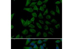Immunofluorescence analysis of U2OS cells using PLOD2 Polyclonal Antibody (PLOD2 Antikörper)