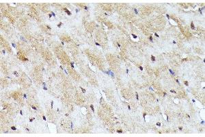 Immunohistochemistry of paraffin-embedded Mouse heart using YAP1 Polyclonal Antibody at dilution of 1:100 (40x lens). (YAP1 Antikörper)