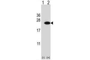Western blot analysis of CIRBP (arrow) using rabbit polyclonal CIRBP Antibody (C-term) . (CIRBP Antikörper  (C-Term))