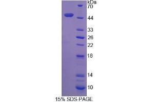 SDS-PAGE analysis of Human DCTN2 Protein. (Dynamitin Protein)
