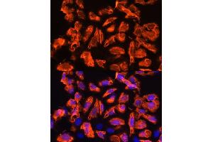 Immunofluorescence analysis of U2OS cells using TCTN1 Rabbit pAb (ABIN7270757) at dilution of 1:100. (TCTN1 Antikörper  (AA 130-310))