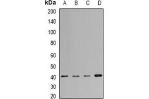 Western blot analysis of MacroH2A1 expression in Jurkat (A), Hela (B), mouse liver (C), rat lung (D) whole cell lysates. (H2AFY Antikörper)