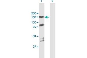 Western Blot analysis of PARP1 expression in transfected 293T cell line by PARP1 MaxPab polyclonal antibody. (PARP1 Antikörper  (AA 1-1014))