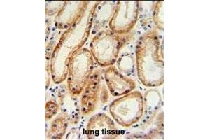 GALNT5 Antibody (N-term) (ABIN653934 and ABIN2843166) IHC analysis in formalin fixed and paraffin embedded human normal lung tissue followed by peroxidase conjugation of the secondary antibody and DAB staining. (GALNT5 Antikörper  (N-Term))