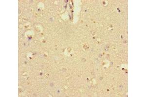 Immunohistochemistry of paraffin-embedded human brain tissue using ABIN7145840 at dilution of 1:100