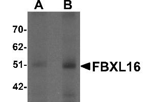 Western Blotting (WB) image for anti-F-Box and Leucine-Rich Repeat Protein 16 (FBXL16) (C-Term) antibody (ABIN1030390) (FBXL16 Antikörper  (C-Term))