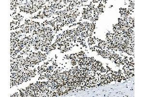 IHC analysis of HOXD11 using anti-HOXD11 antibody (ABIN7603174). (HOXD11 Antikörper  (N-Term))