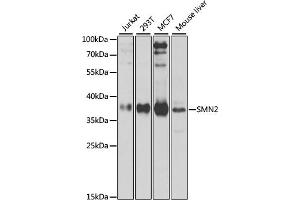 Western blot analysis of extracts of various cell lines, using SMN2 antibody (ABIN6127948, ABIN6148135, ABIN6148138 and ABIN6216175) at 1:1000 dilution. (SMN2 Antikörper  (AA 1-197))