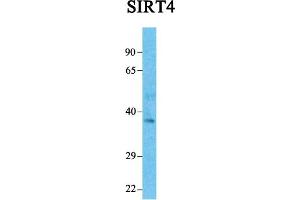 Host:  Rabbit  Target Name:  SIRT4  Sample Tissue:  Human Fetal Liver  Antibody Dilution:  1. (SIRT4 Antikörper  (Middle Region))