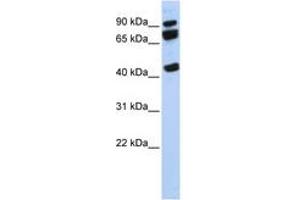 Image no. 1 for anti-DEAD (Asp-Glu-Ala-Asp) Box Polypeptide 17 (DDX17) (AA 107-156) antibody (ABIN6742675) (DDX17 Antikörper  (AA 107-156))