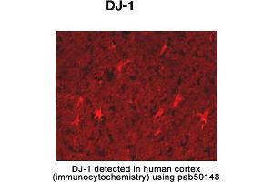 Image no. 2 for anti-Parkinson Protein 7 (PARK7) (AA 150-189), (C-Term) antibody (ABIN363457) (PARK7/DJ1 Antikörper  (C-Term))