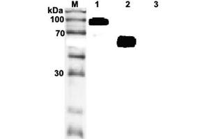 Western blot analysis of recombinant human soluble ST2 using anti-ST2 (human), mAb (ST33868)  at 1:2,000 dilution.
