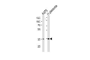 AKR1B1 Antikörper  (C-Term)
