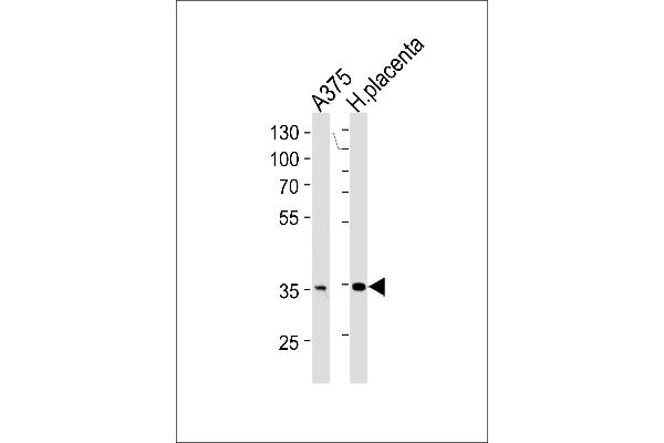 AKR1B1 Antikörper  (C-Term)