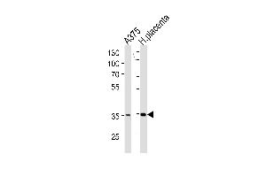 AKR1B1 Antibody (C-term) (ABIN389205 and ABIN2839363) western blot analysis in  cell line and human placenta tissue lysates (35 μg/lane). (AKR1B1 Antikörper  (C-Term))