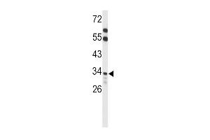 ACOT8 Antikörper  (C-Term)