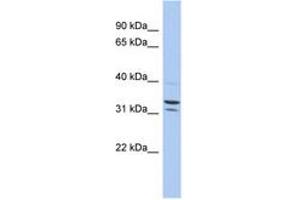 Image no. 1 for anti-Family with Sequence Similarity 92, Member B (FAM92B) (AA 71-120) antibody (ABIN6743910) (FAM92B Antikörper  (AA 71-120))
